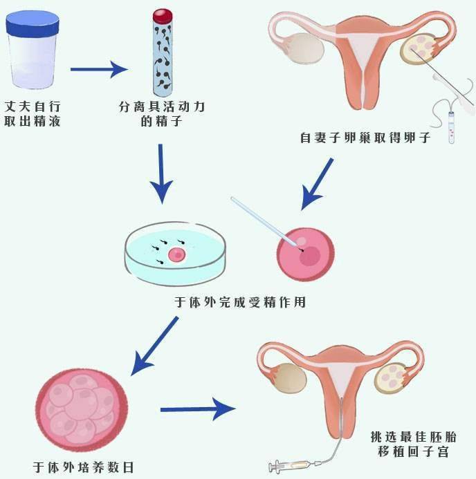 俄罗斯代孕