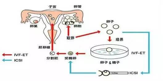 达州捐卵招聘